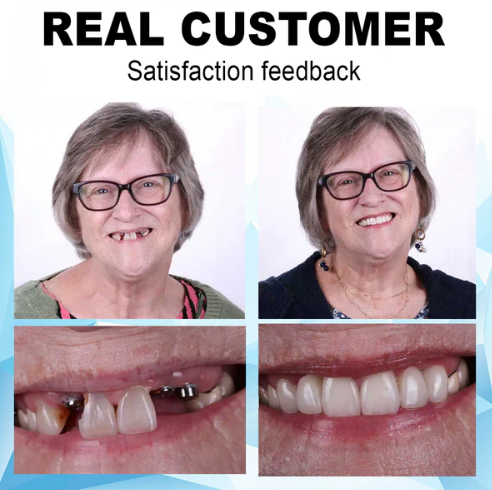 Dobshow ™ Silicone Reline Denture Set (⏰Limited time discount Last 30 minutes⏰)